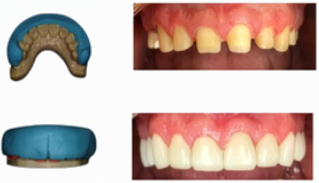 Prep guide & Mock-up index