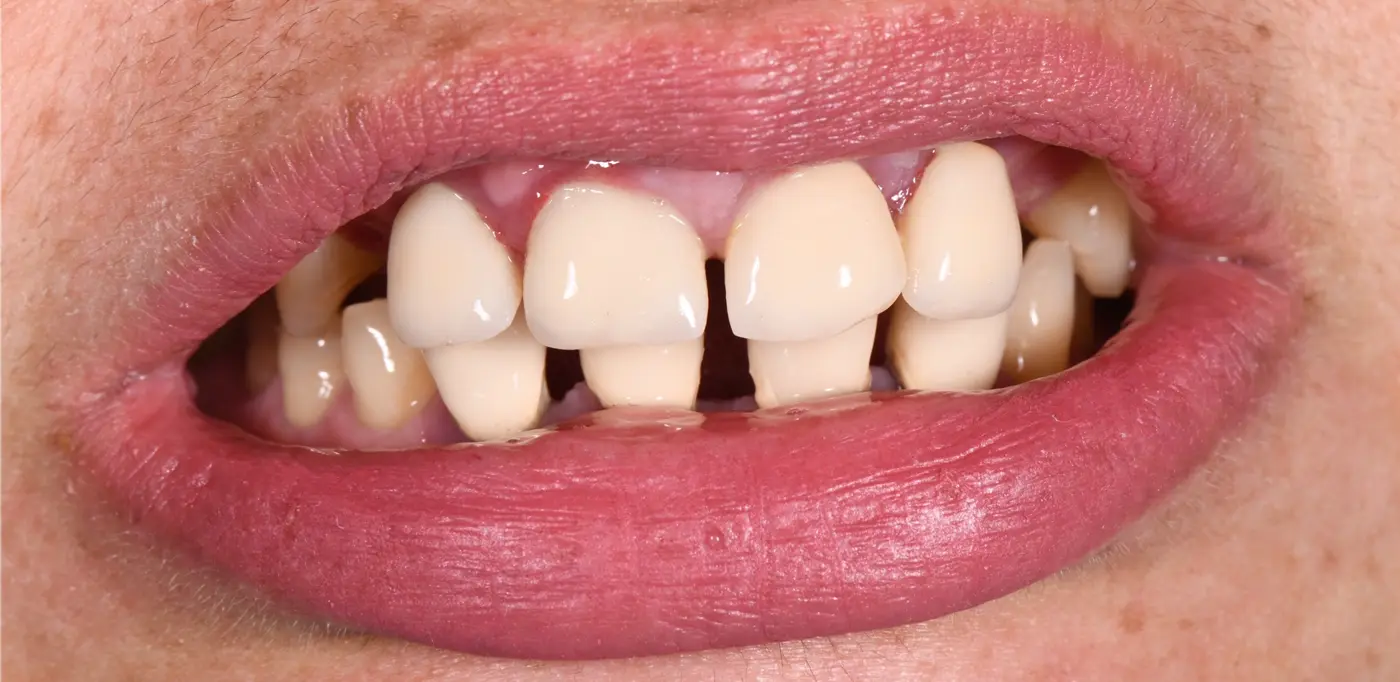 clinical-case-004-1