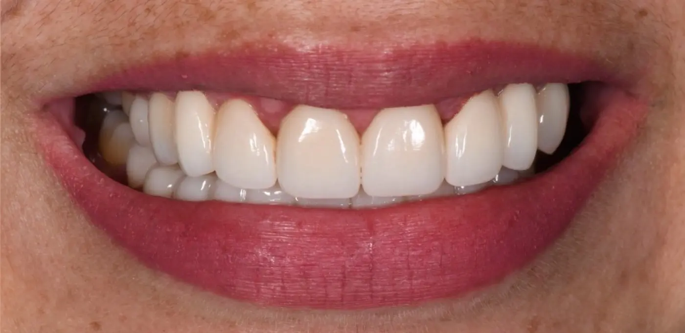 clinical-case-004-2
