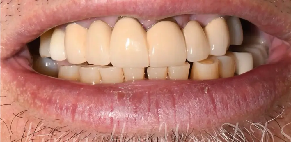 clinical-case-005-1