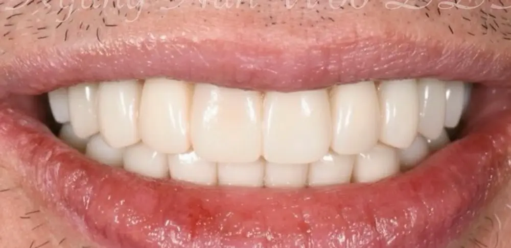clinical-case-005-2